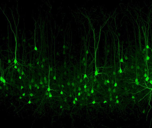 L’immagine mostra alcuni neuroni della corteccia visiva, marcati con una proteina fluorescente. L’azione eccitatoria del neurotrasmettirore GABA durante lo sviluppo, come descritto nell’articolo, regola in maniera fine l’attività e la plasticità di questi neuroni nell’adulto