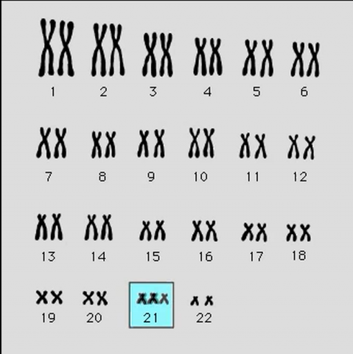 cromosoma21