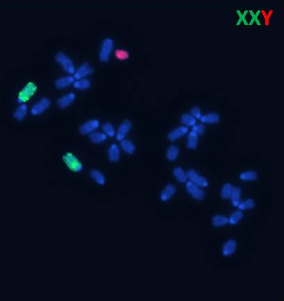 cromosoma1