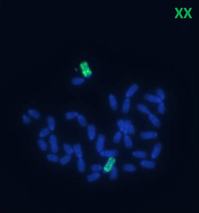 cromosoma2