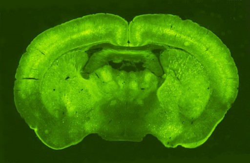  Immagine del cervello trasdotto con il virus terapeutico esprimente la proteina fluorescente GFP 