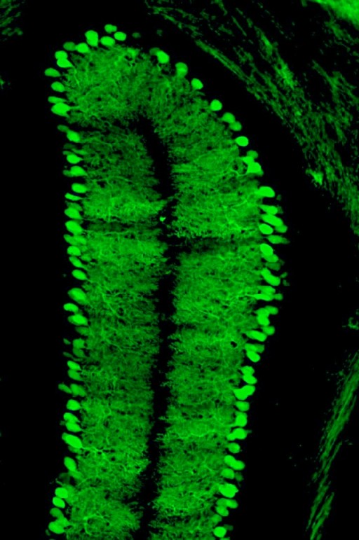 Particolare del cervelletto con i neuroni trasdotti con il virus terapeutico esprimente la proteina fluorescente GFP.