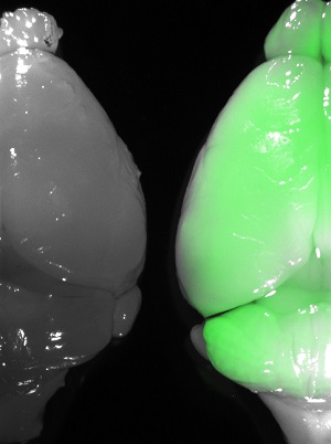  Confronto tra un cervello trasdotto con il virus terapeutico esprimente la proteina fluorescente GFP (a destra) e quello invece non trasdotto (a destra). Immagine D: Immagine dei neuroni della corteccia cerebrale (rossi) trasdotti con il virus terapeutico esprimente la GFP (verdi). 
