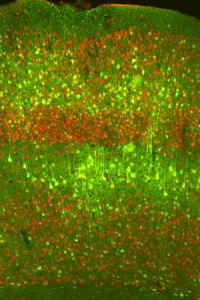 Immagine dei neuroni della corteccia cerebrale (rossi) trasdotti con il virus terapeutico esprimente la GFP (verdi). 