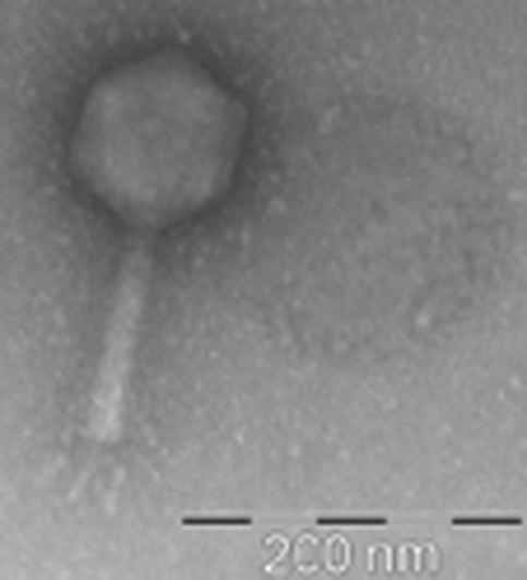 Fotografia al microscopio elettronico di virus marino coltivato in laboratorio. (Credits: Elena Lara)
