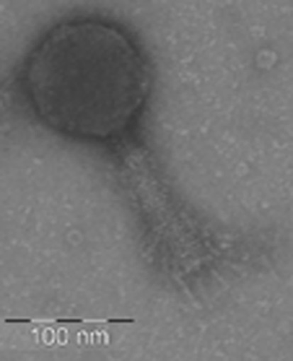 Fotografia al microscopio elettronico di virus marino coltivato in laboratorio. (Credits: Elena Lara)